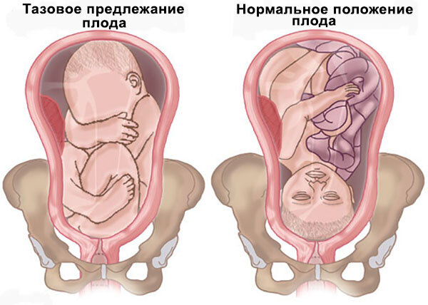 38 неделя беременности от зачатия